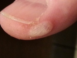 Maybe get a blister on your thumb.